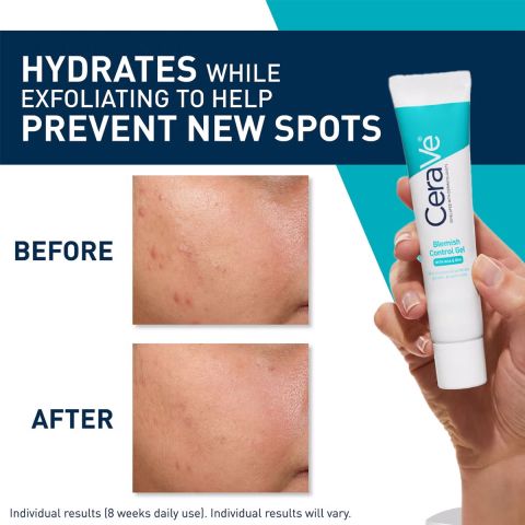 CeraVe - Soin Concentre Anti-Imperf - 40 ml