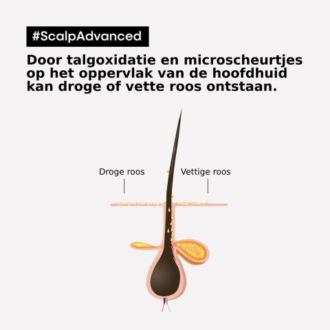 L'Oréal Professionnel - Scalp Advanced - Anti-Schuppen Shampoo