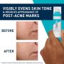 CeraVe - Serum Retinol AntiI-Marques - 30 ml