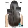 L'Oréal Professionnel - Scalp Advanced - Anti-Fettigkeit - 2-in-1 Haarkur für fettiges Haar - 250 ml